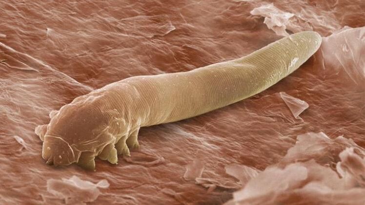 a worm that lives under human skin