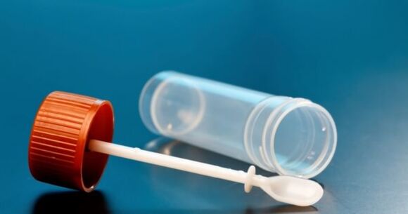 Parasite tests