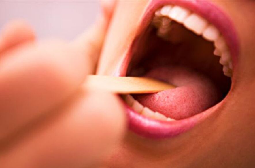 Types of parasites in the human mouth