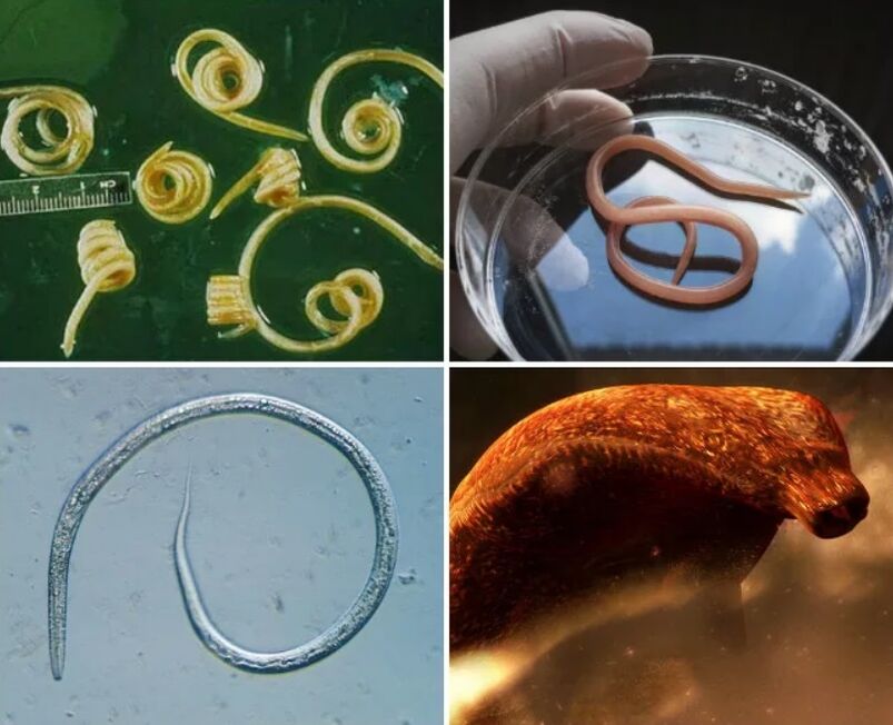 Types of worms in the human body